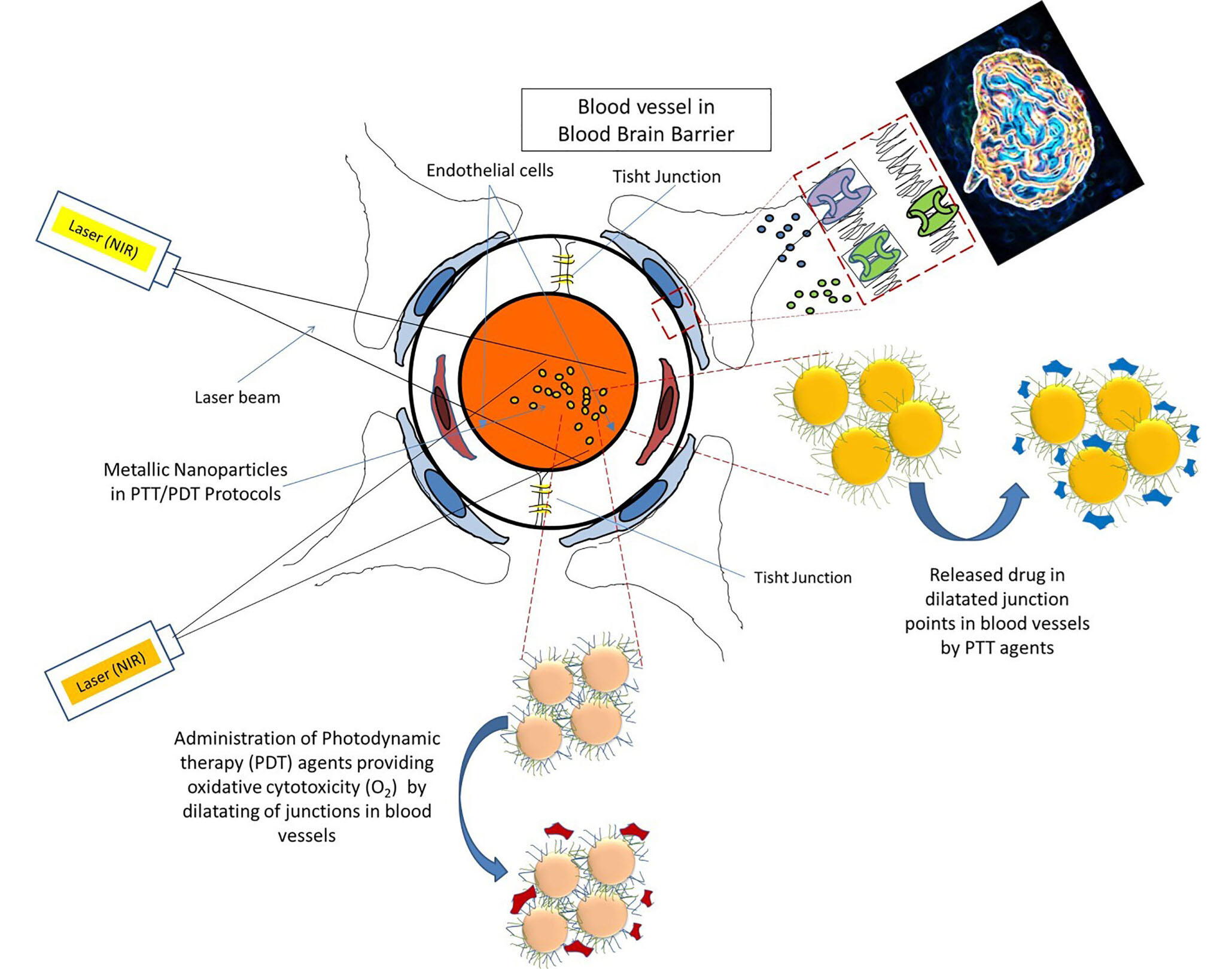 Combined PDT/PTT approaches for the treatment of brain tumors