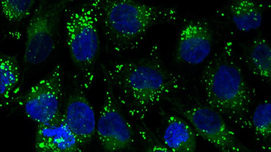 Fluorescence microscopy image of the intracellular distribution of supramolecular cages encapsulating drugs (green fluorescence) in melanosomes in human cancer cells (blue fluorescence = cell nuclei)
