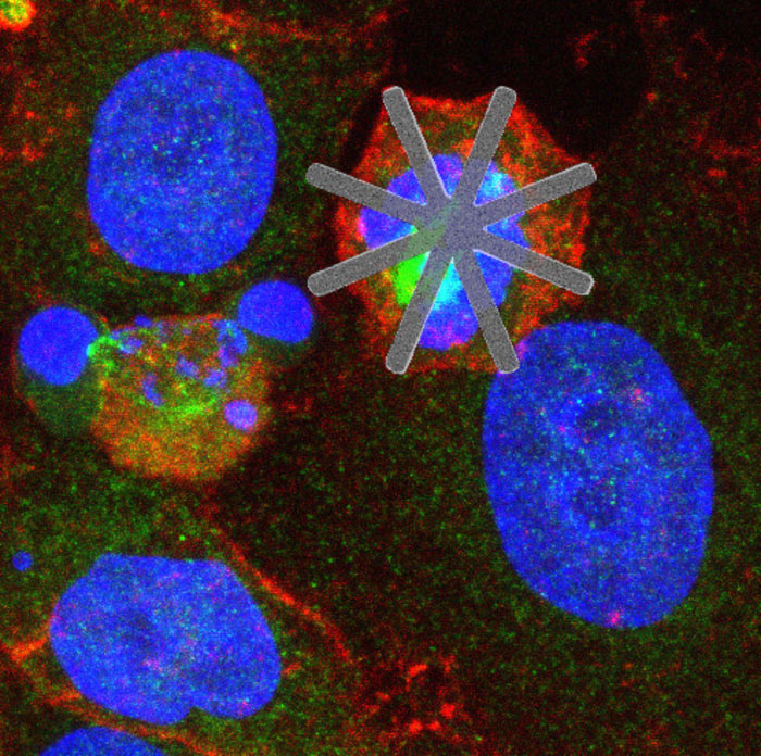 HeLa cell with a star-shaped silicon chip inside