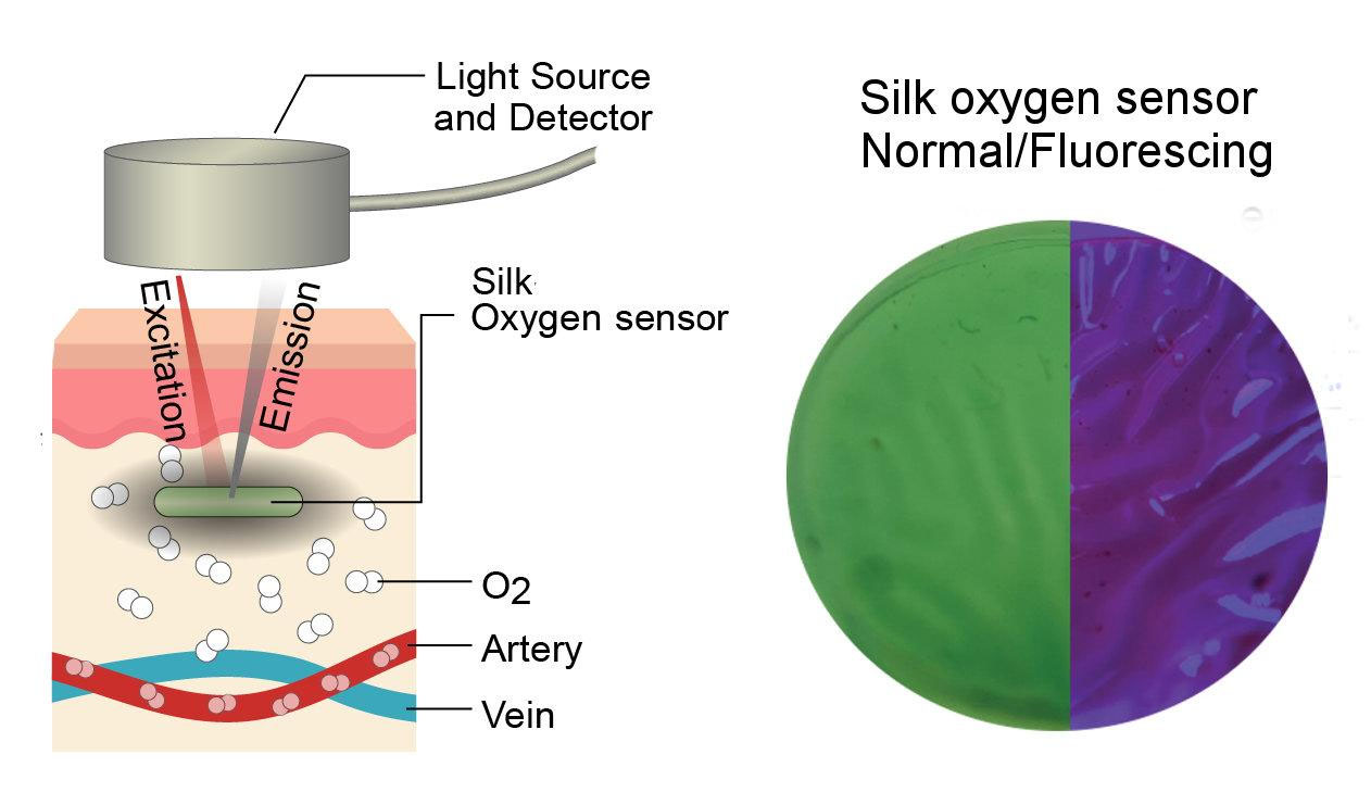 The small disc of a silk film oxygen sensor glows purple when exposed to UV light and oxygen