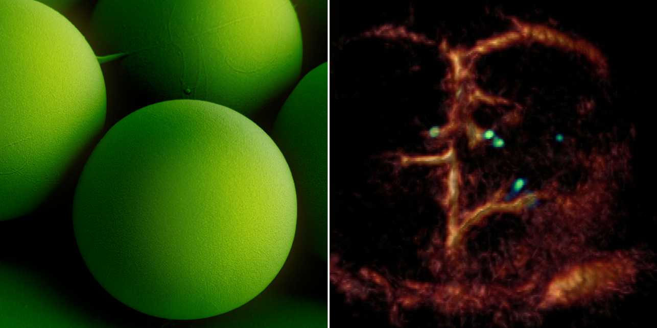 Left image: Spherical, green microrobots. Right image: Multiple microrobots in a blood vessel.