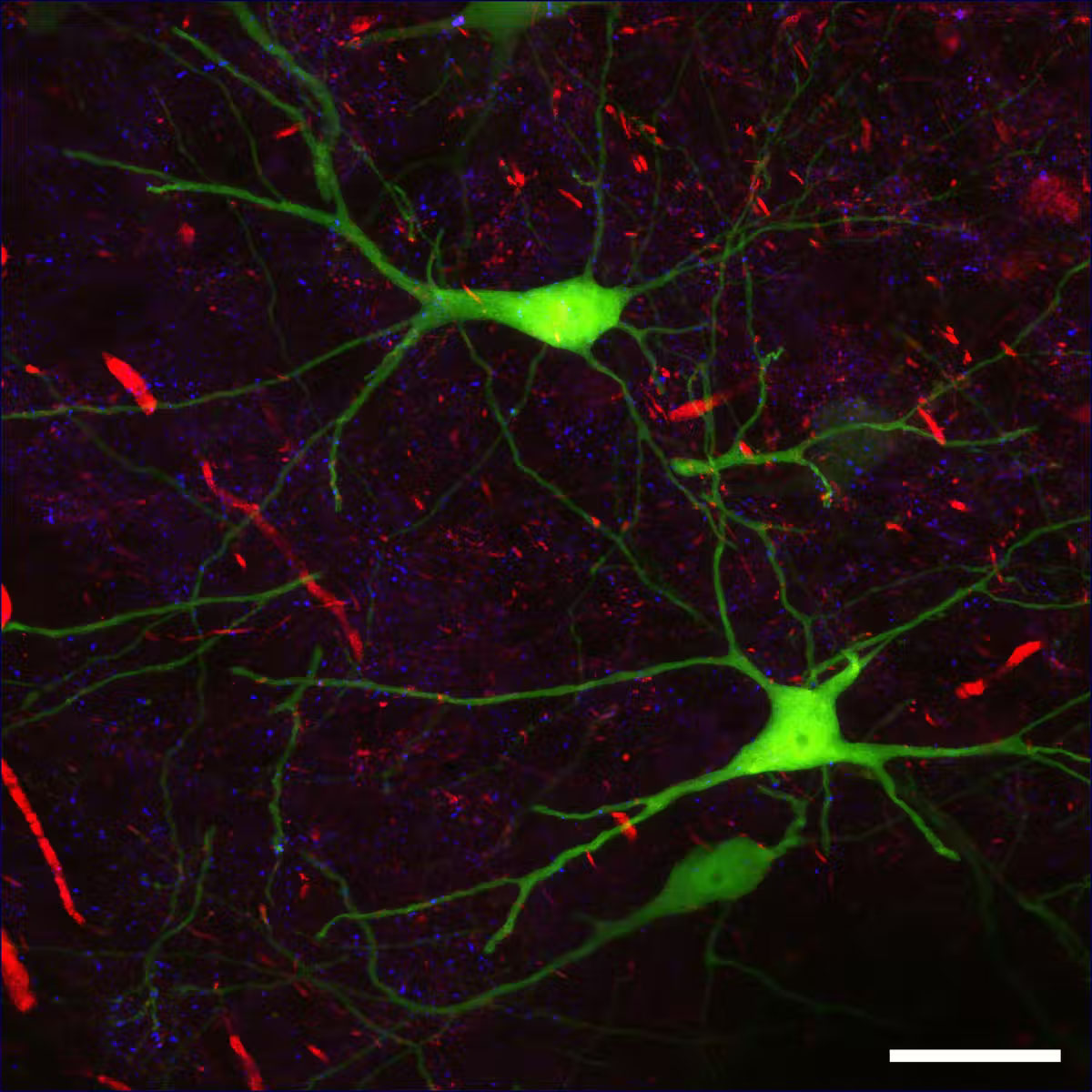 Different types of synapses in a mouse brain slice