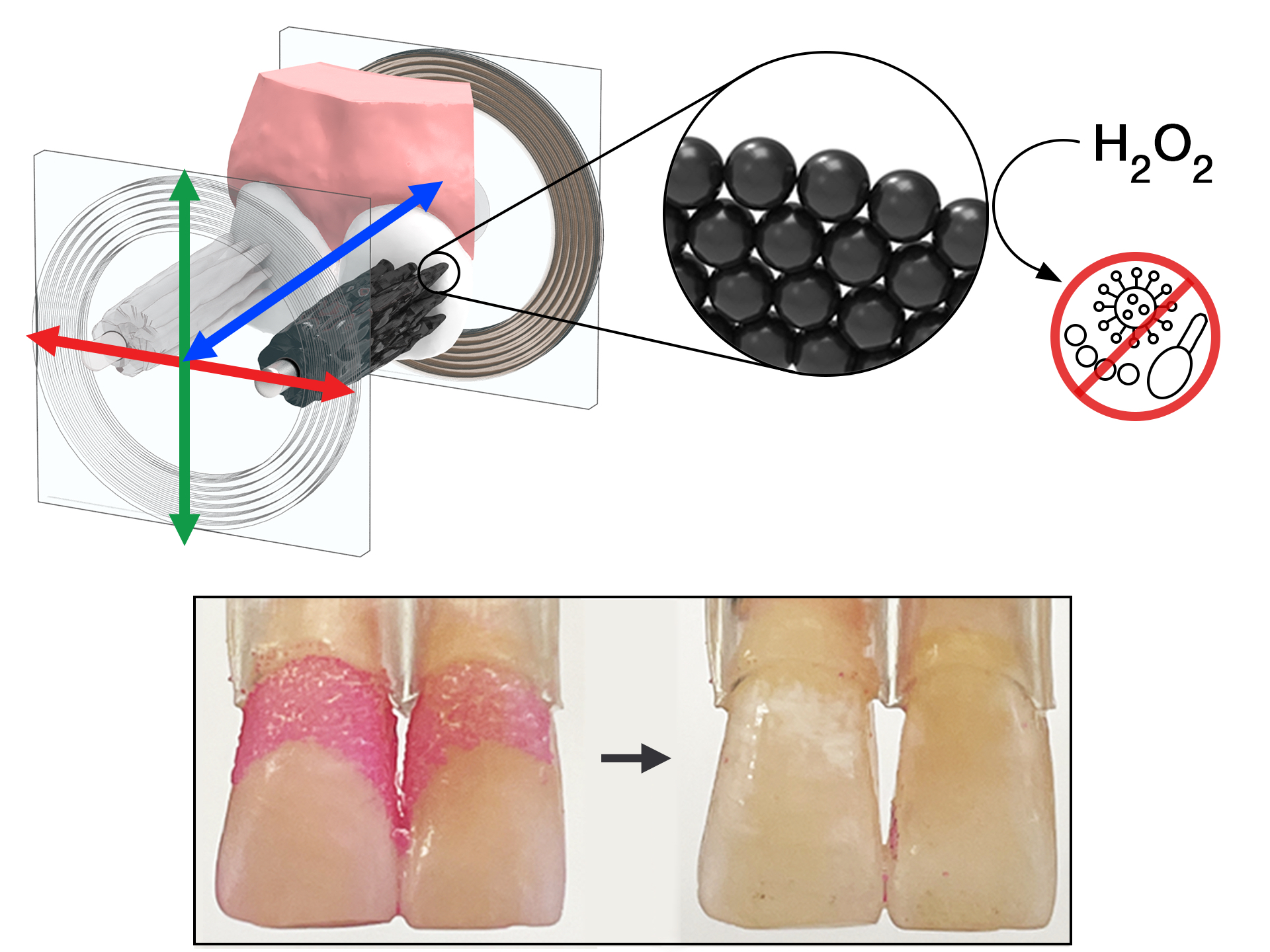 Arranged in bristle-like structures, a robotic microswarm of iron oxide nanoparticles effectively cleaned plaque from teeth.