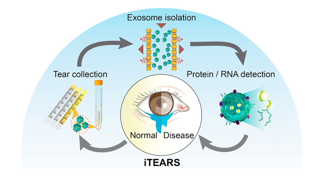 tear-exosomes analysis via rapid-isolation system