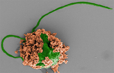 Colored SEM image of a pneumonia-fighting microrobot made of an algae cell (green) covered with biodegradable polymer nanoparticles (brown)