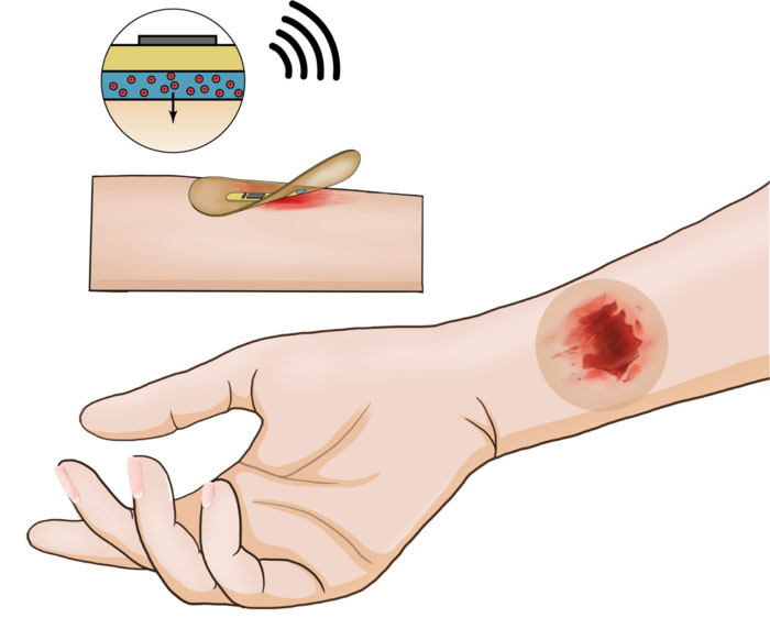 Drawing of wireless smart bandage on human arm