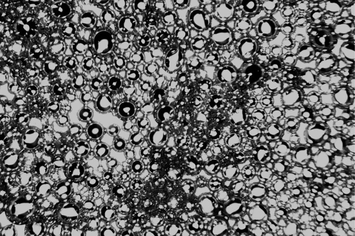 Microscopy image of nanobubbles