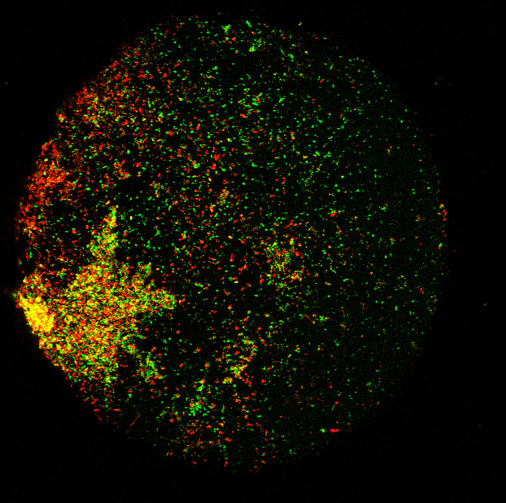 Microbes on a zebrafish egg. Alive microbes are coloured green, dead microbes are coloured red or yellow