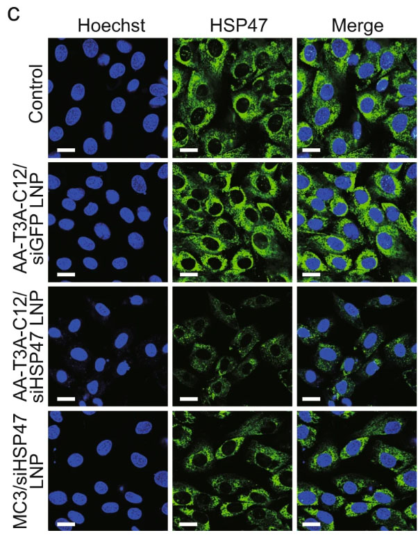Immunofluorescence staining shows different ligand-tethered LNPs’ abilities to knock down HSP47 in activated fibroblasts