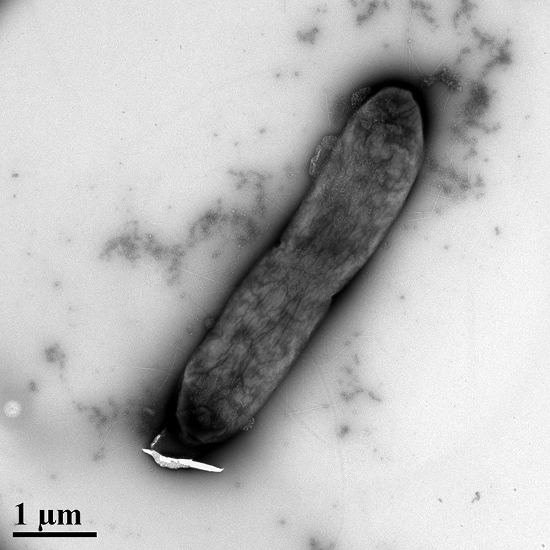 A single E. coli bacteria cell surrounded by silver nanoparticles