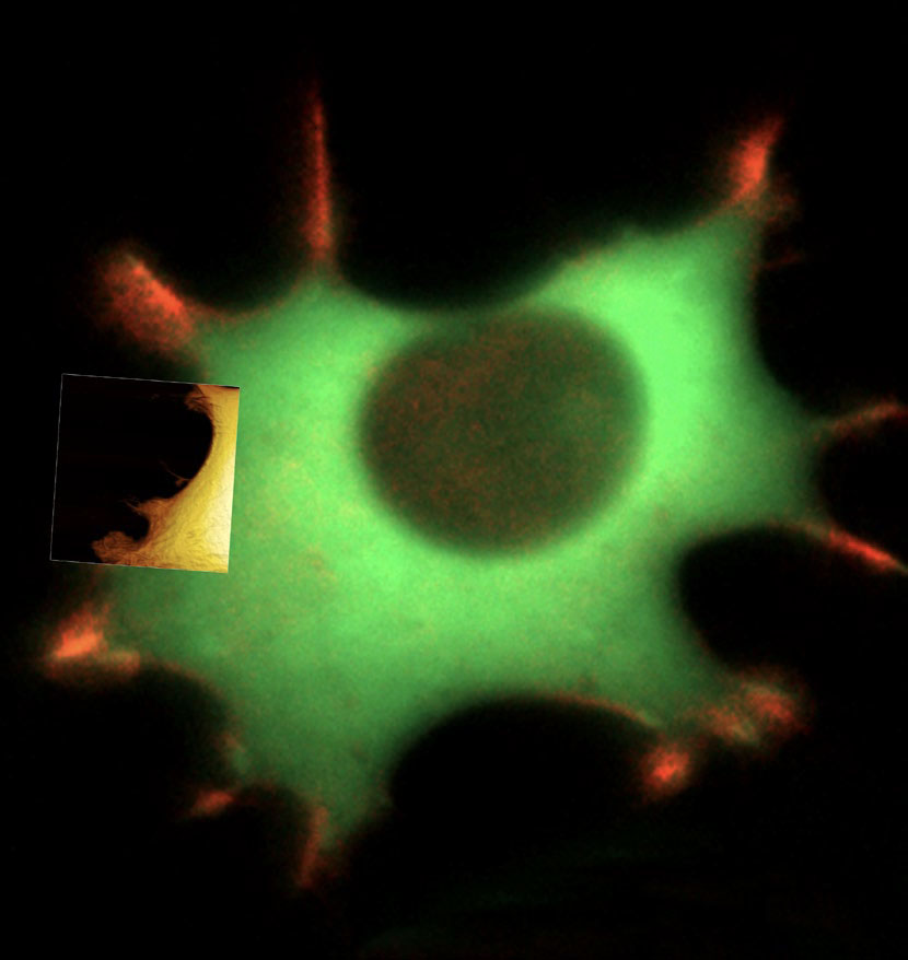 Live fibroblast imaged with inverted light microscope and AFM in cell culture conditions