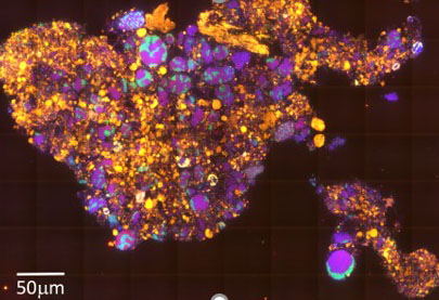 Image of the microbe community (purple and green) within sediment particles (yellow)