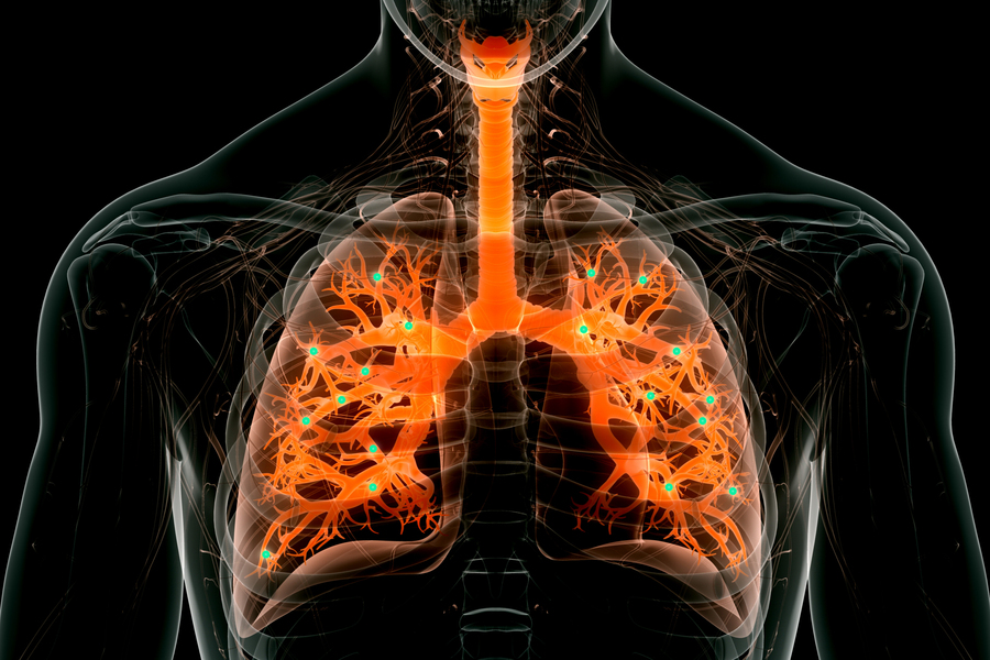 nanoparticle that can be administered to the lungs
