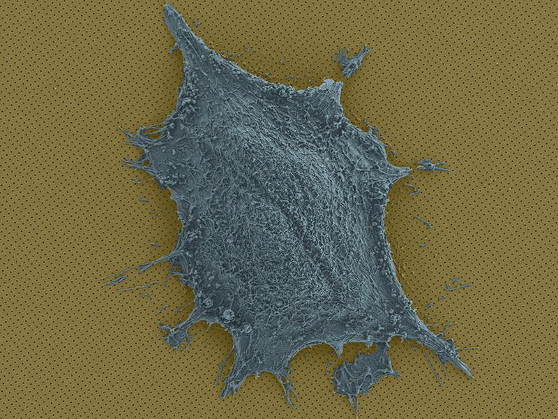Single cell on a chip