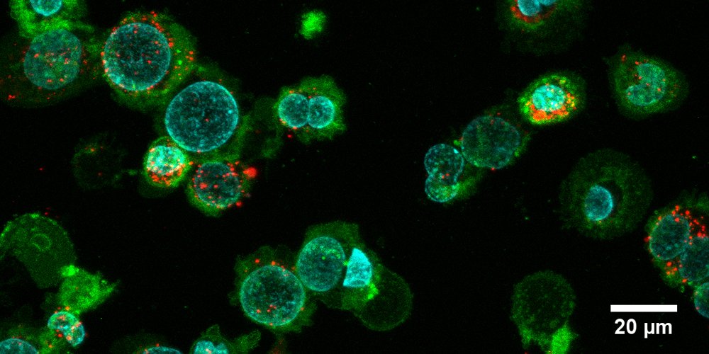 extracellular vesicles (red) produced using the new technique are absorbed in vitro by immune cells (green; nucleus in turquoise)