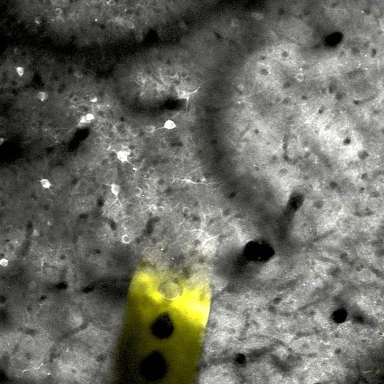 Two-photon microscopy image of a nanoelectrode (yellow) after two months implanted within the brain of a mouse, with healthy active neurons (bright regions) neighboring the implant