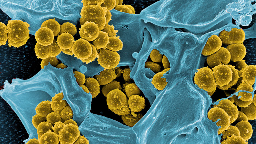 antibiotic-resistant staphylococci (yellow) are fought by a white blood cell