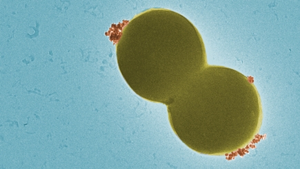 Magnetic nanoparticles (red) bind specifically to spherical bacteria (yellow)