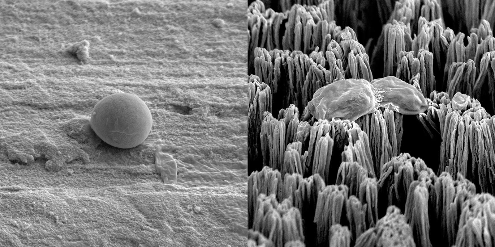 An intact Candida cell on polished titanium surface (left), and a ruptured Candida cell on the micro-spiked titanium surface (right)