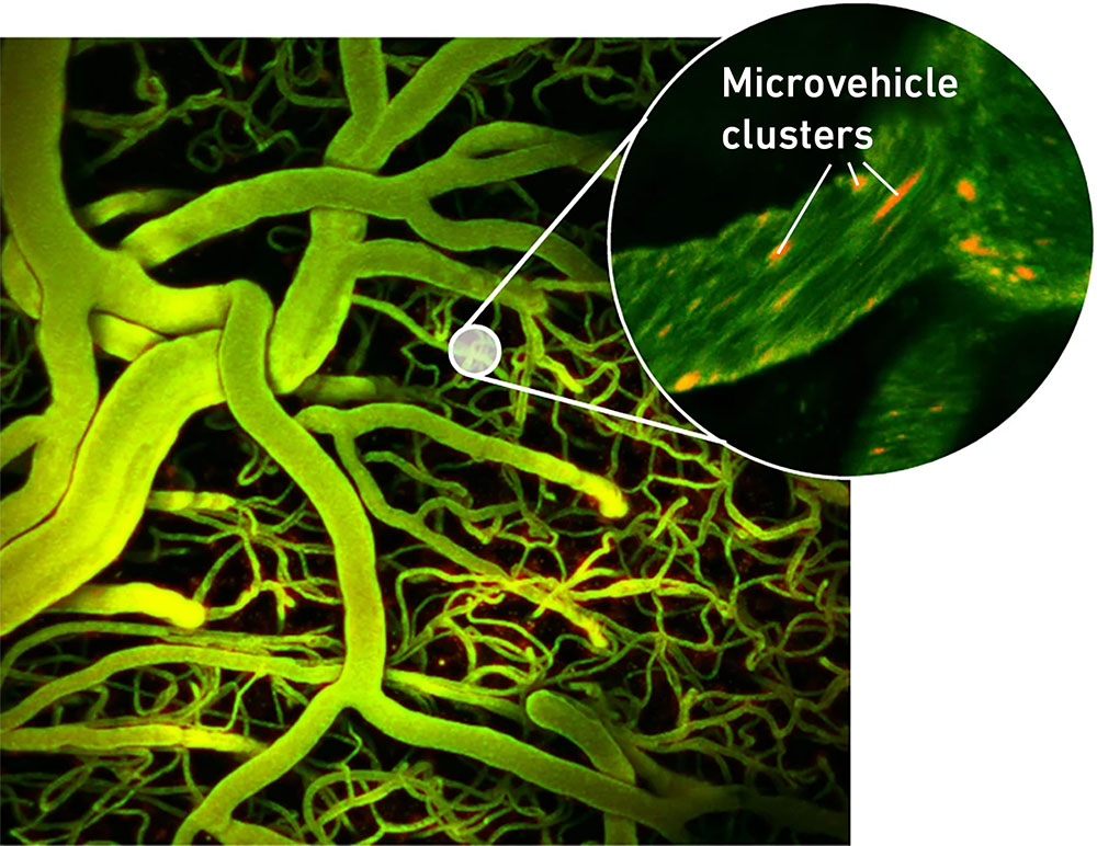 Blood vessels in the brain with clusters of microvehicles in orange (microscopy image)