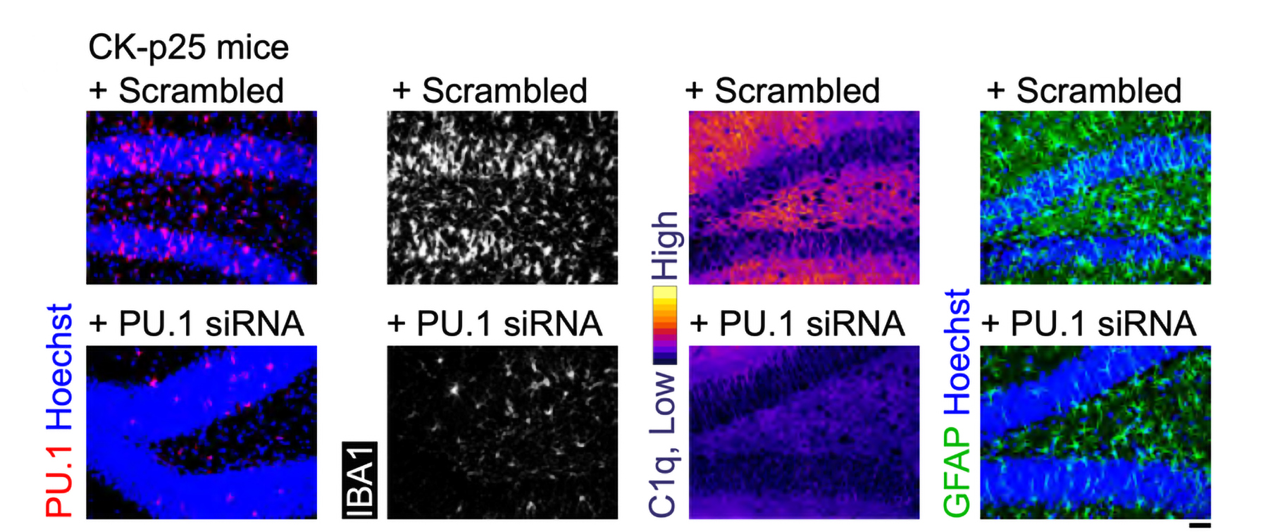 an siRNA delivered by a lipid nanoparticle was able to reduce expression of the protein PU.1 and other related markers (IBA1, C1q, GFAP)
