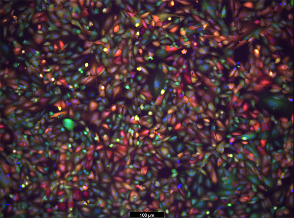 Fluorescence microscopy image showing LNPs delivering fluorescent protein (mCherry) mRNA to brain endothelial cells