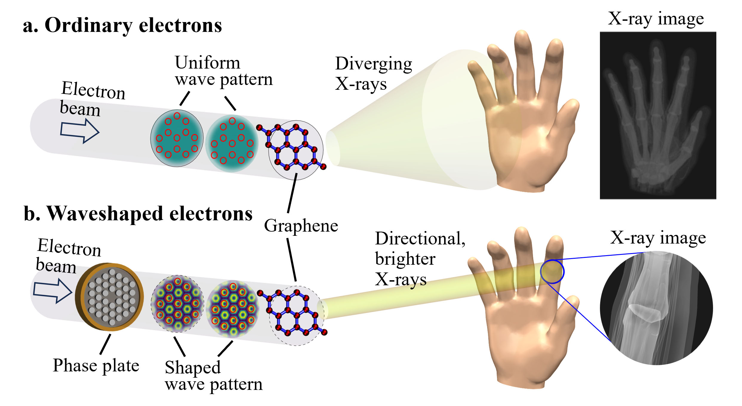 Imagen de rayos X de electrones ordinarios o electrones en forma de onda.
