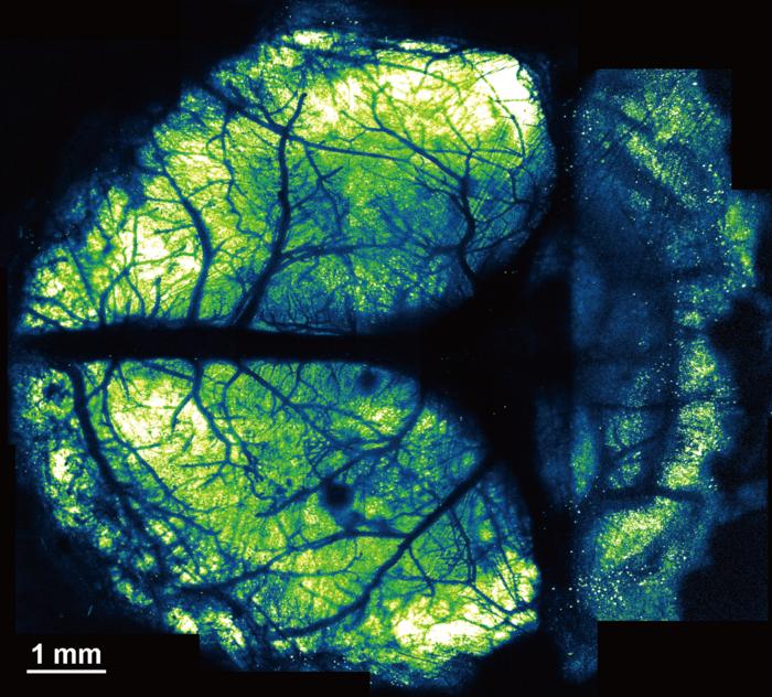 fluoropolymer nanosheets covered with light-curable resin to create larger cranial windows