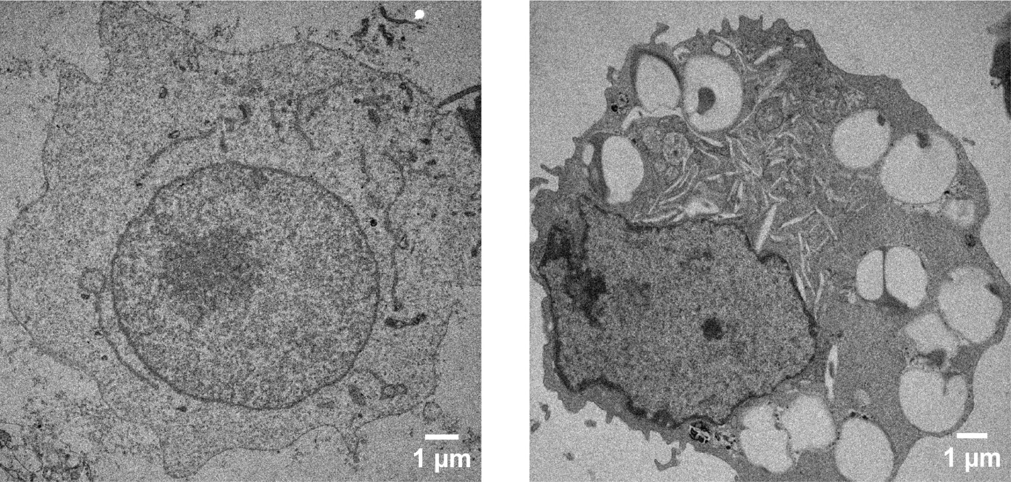 cells with and without nanoparticle uptake