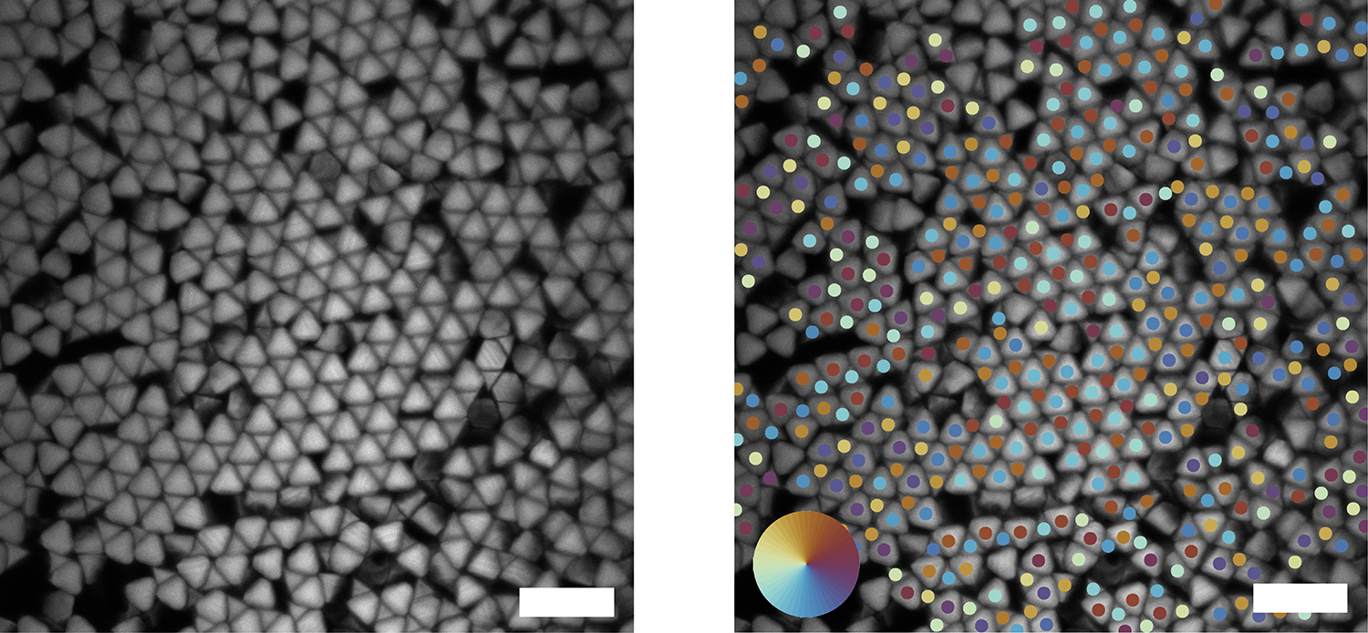Confocal images of truncated tetrahedrons forming several quasi-diamond grains