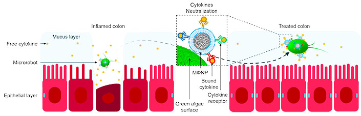Illustration of a microrobot neutralizing pro-inflammatory cytokines to treat an inflamed colon in IBD