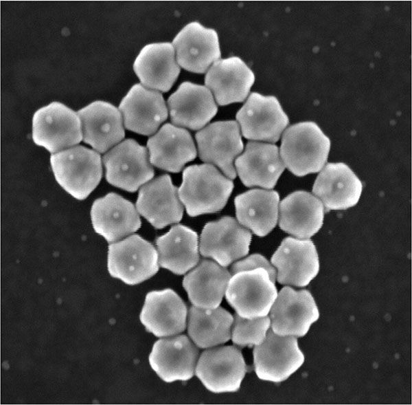 A scanning electron microscope image of chiral gold nanoparticles developed for a new microfluidic chip capable of detecting signatures of lung cancer from blood plasma samples