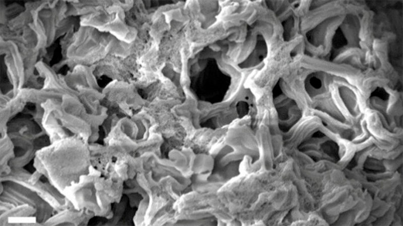 Microscopy of a hypergolic, nanoporous carbon