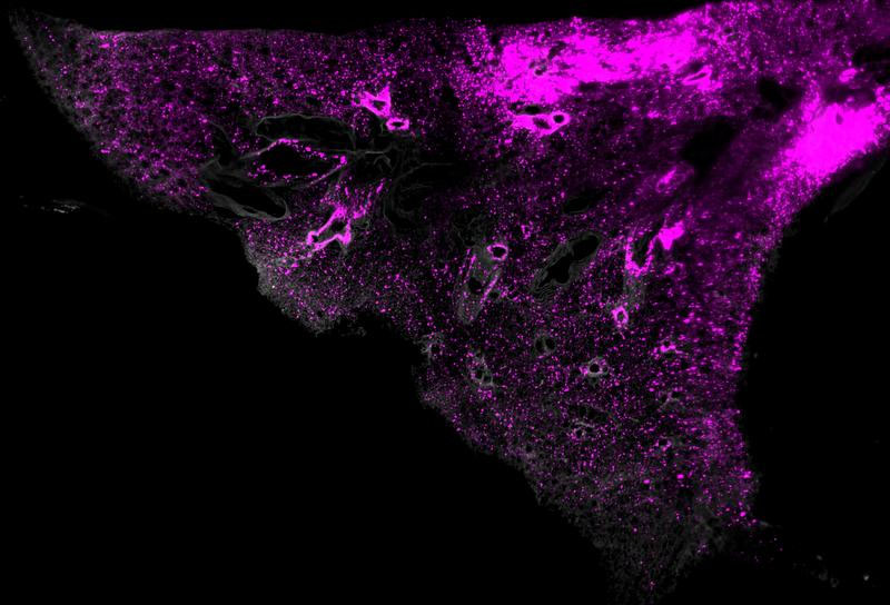 Lipid nanoparticles visualized using SCP-Nano technology at the cellular level in lung tissue