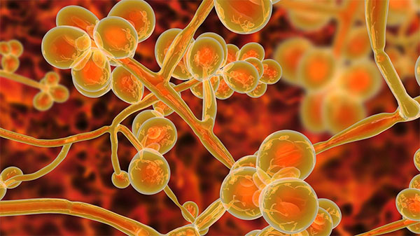 Candida auris