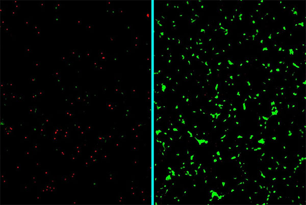 Labeled micrographs of human neurons exposed to amyloid-beta proteins and either left untreated (left) or treated with nanotherapy