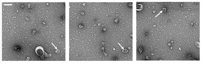 extracellular vesicles