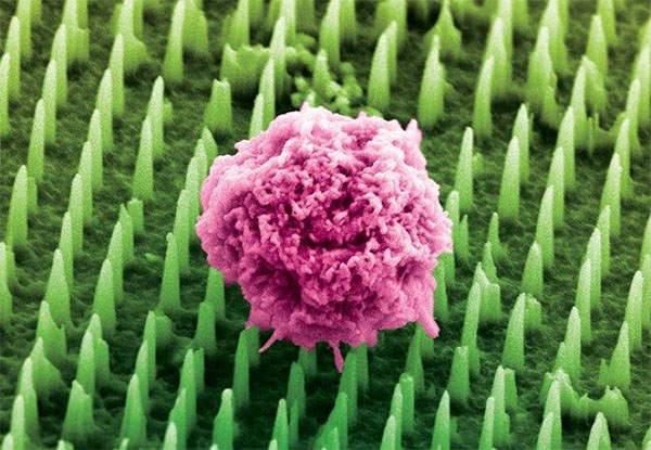 colorized image of nanoneedles