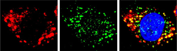 Stress granules (red) form when a cell is under stress. PHOTON, developed by UT Southwestern researchers, allows scientists to systematically identify RNA species (green) that are recruited into stress granules. The cell nucleus is stained blue.