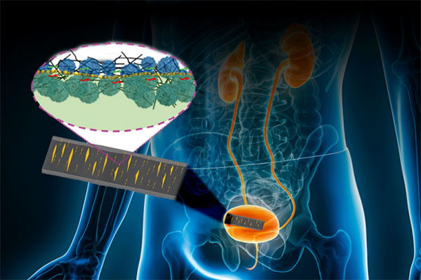 A flexible, skin-like sensor can monitor movement and electrical signals inside the body, with the potential to aid healing and bladder control