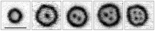 X-ray microscopy images of the magnetization textures showing the different orders of skyrmions bags, ranging from the empty skyrmionium to a bag filled with four skyrmions. The scale bar is 500 nm