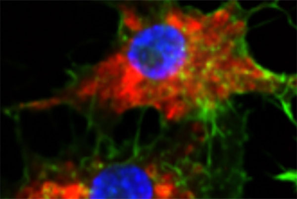 A microscopy image that shows SNAs (in red) taken up into leukemia cells.