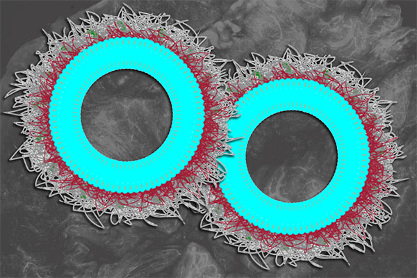 nanoparticles that can deliver an immune-stimulating molecule called IL-12 to ovarian cancer cells
