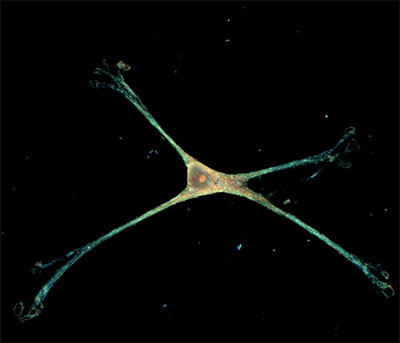 An astrocyte displays natural star shape on new nanowire platform