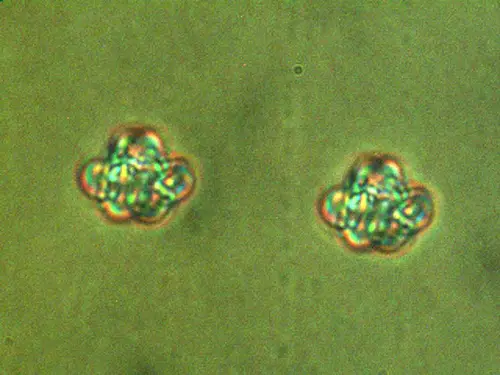 Vortex knots inside a chiral nematic liquid crystal