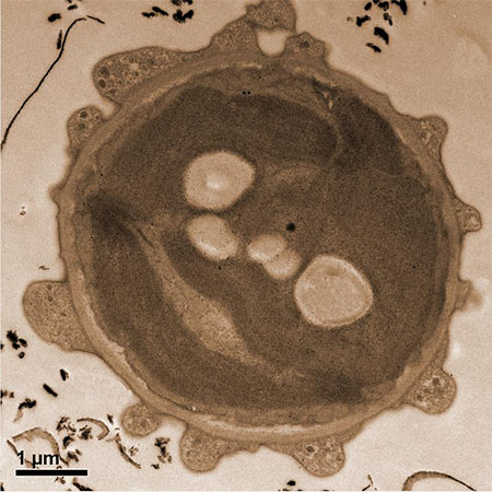 Electron microscope image of algae pre-treated with espresso to create stronger contrasts.
