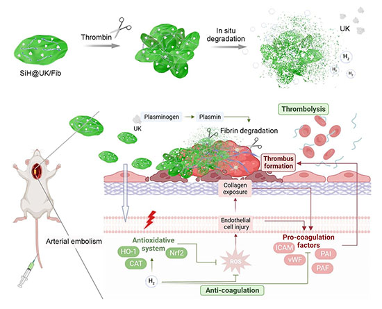 Schematic illustration showing the targeting, anti-coagulation, and thrombolysis mechanisms of the nanothrombolytic (SiH@UK/Fib) against arterial embolism