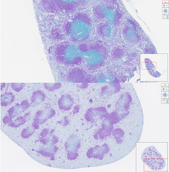 Blue dyed B cells in the spleen of a mouse