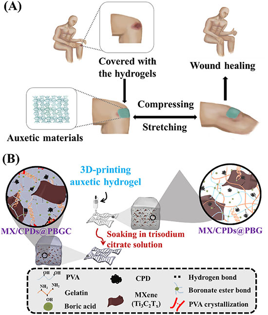 3D‐Printed Auxetic Hydrogel Dressings Reinforced With MXene and Carbonized Polymer Dots for Cascaded Antibacterial and Pro‐Regenerative Effects in Wound Healing