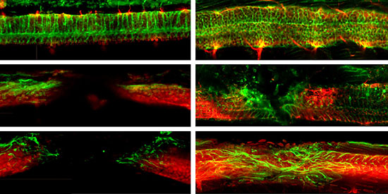 repairing injured spinal cords